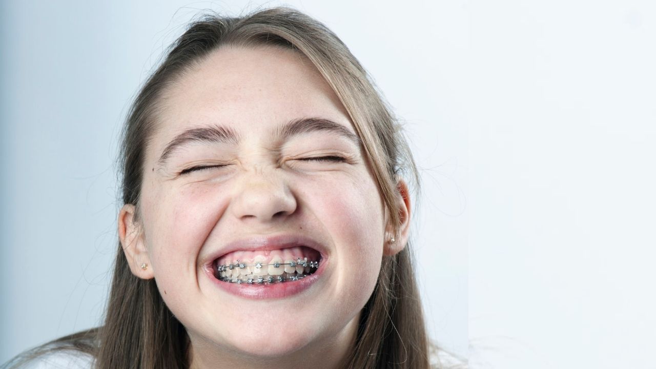 Descubra os tipos de piercing na boca e como cuidar - DentalVidas