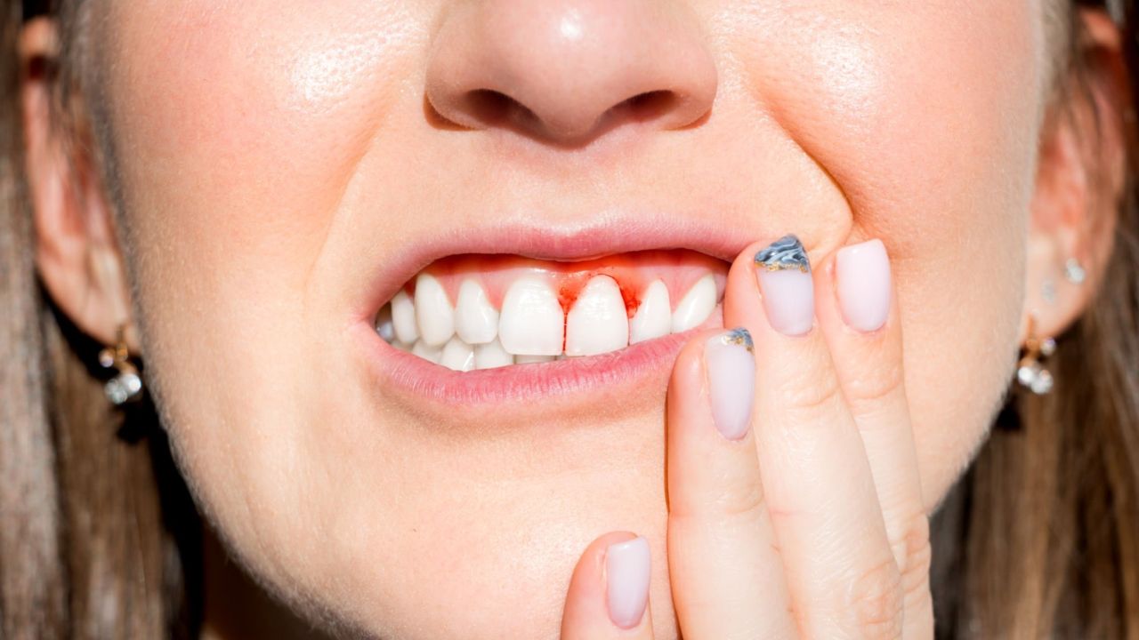 o que é doença periodontal