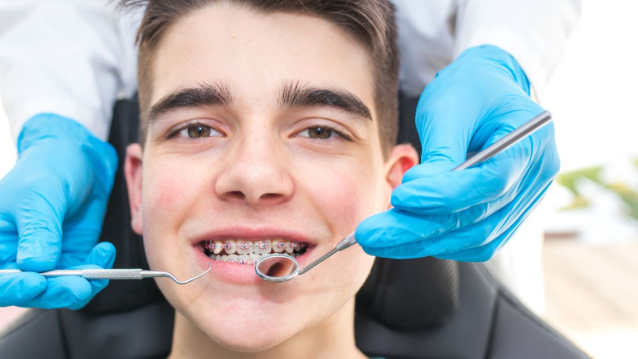 Aparelhos utilizados na ortodontia