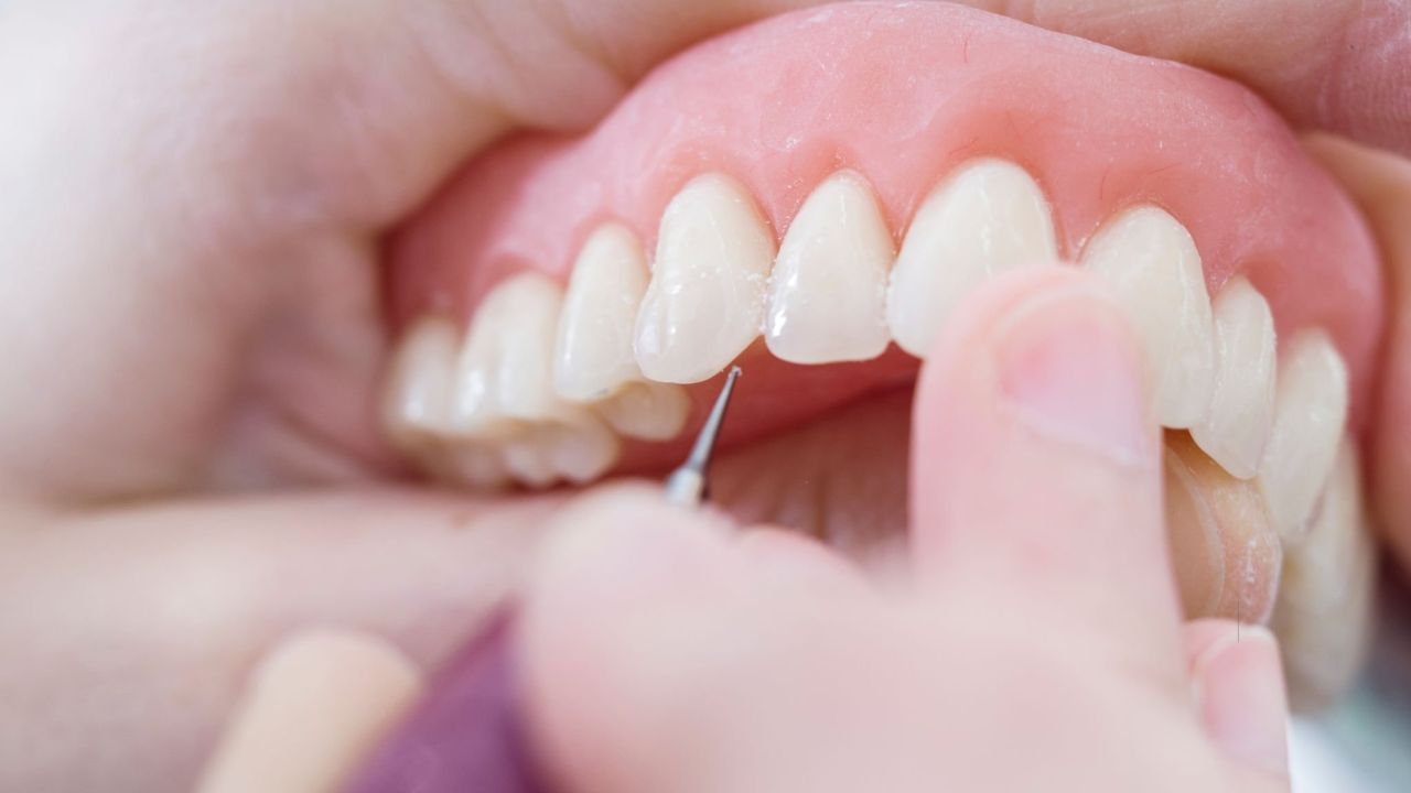 Prótese dentária total em processo de confecção