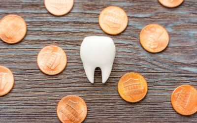 Implante dentário preço