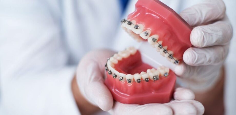 dentista mostrando como funciona o aparelho ortodôntico