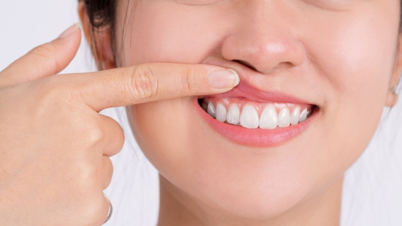 paciente mostrando como aliviar sensibilidade nos dentes