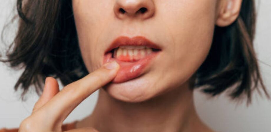 Descubra os tipos de piercing na boca e como cuidar - DentalVidas