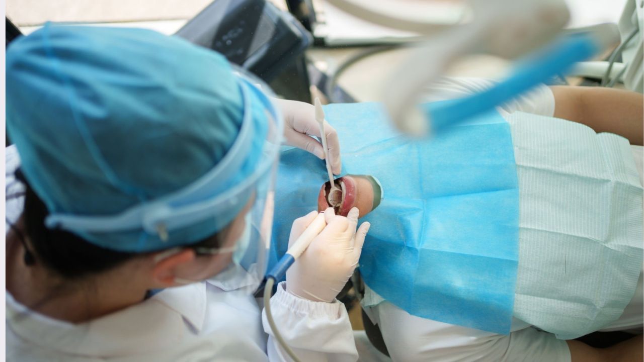 Cirurgião-dentista realizando a remoção do caseum de paciente